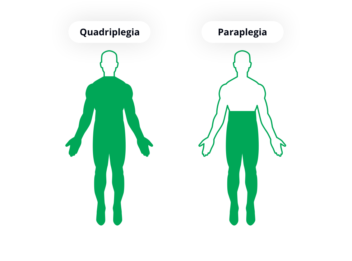 Facts Spinal Cord Img